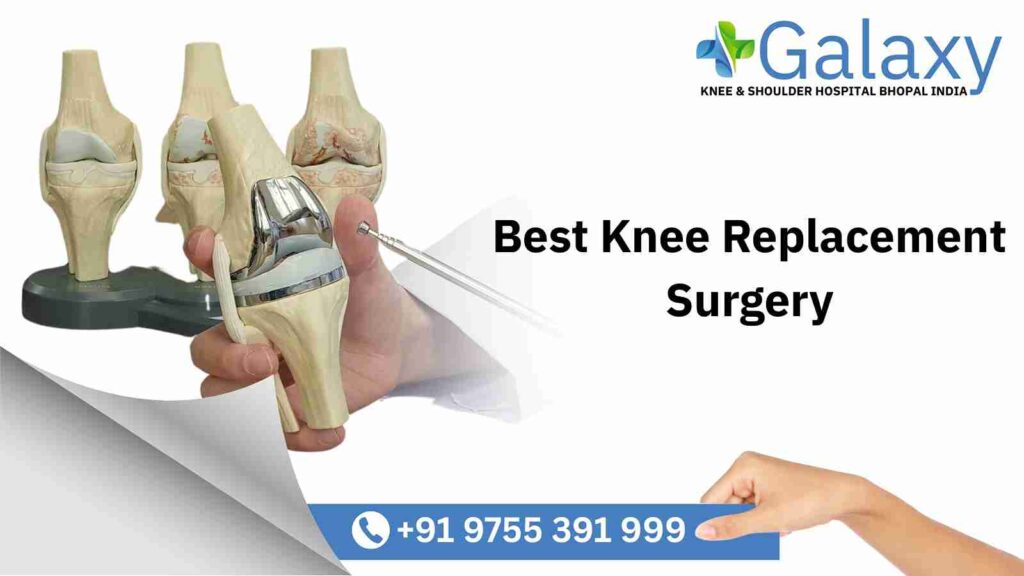 Knee Replacement Surgery