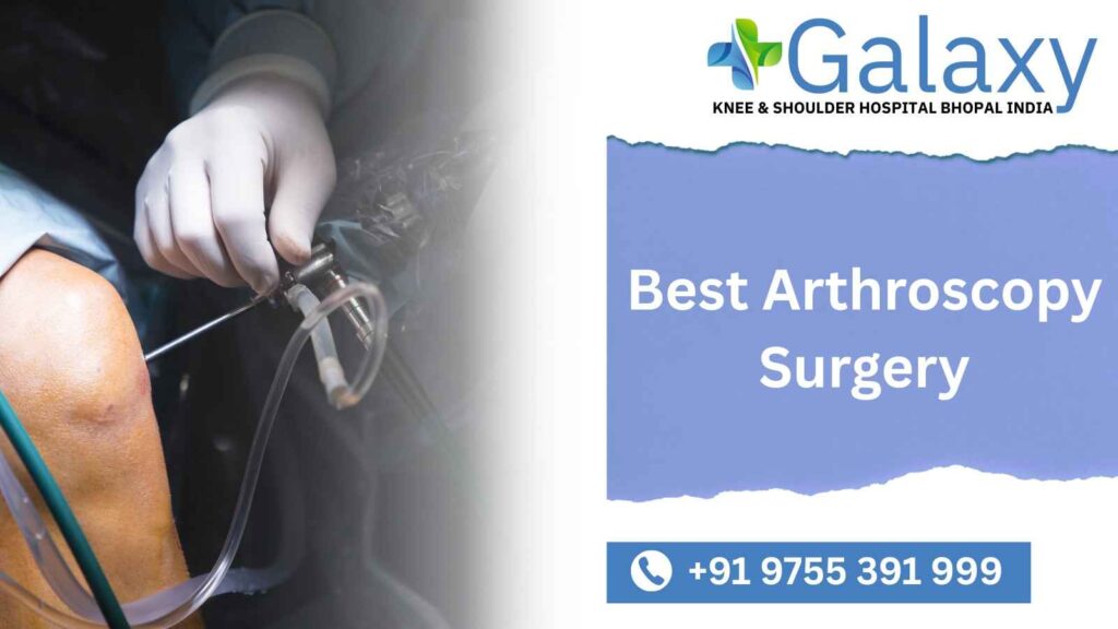 Best Arthroscopy Surgery