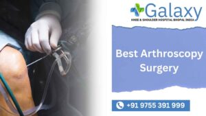 Best Arthroscopy Surgery