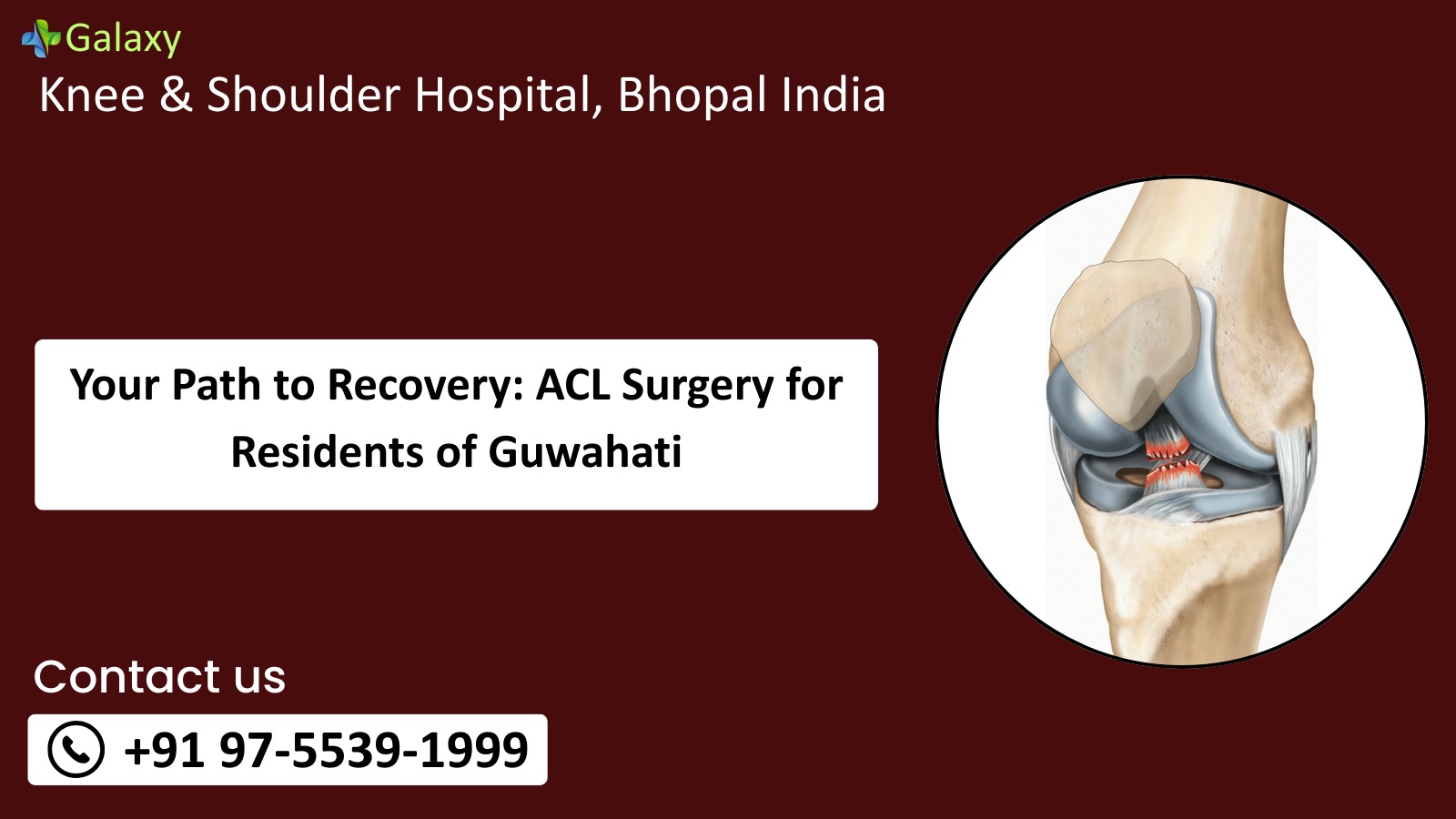 ACL Surgery (6)