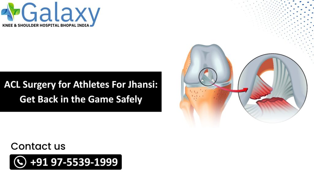 ACL Surgery for Athletes for Jhansi: Get Back in the Game Safely
