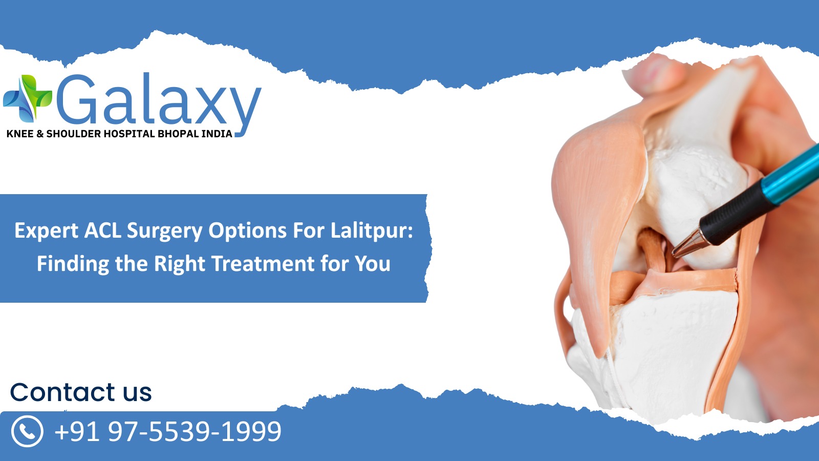Expert ACL Surgery Options for Lalitpur: Finding the Right Treatment for You