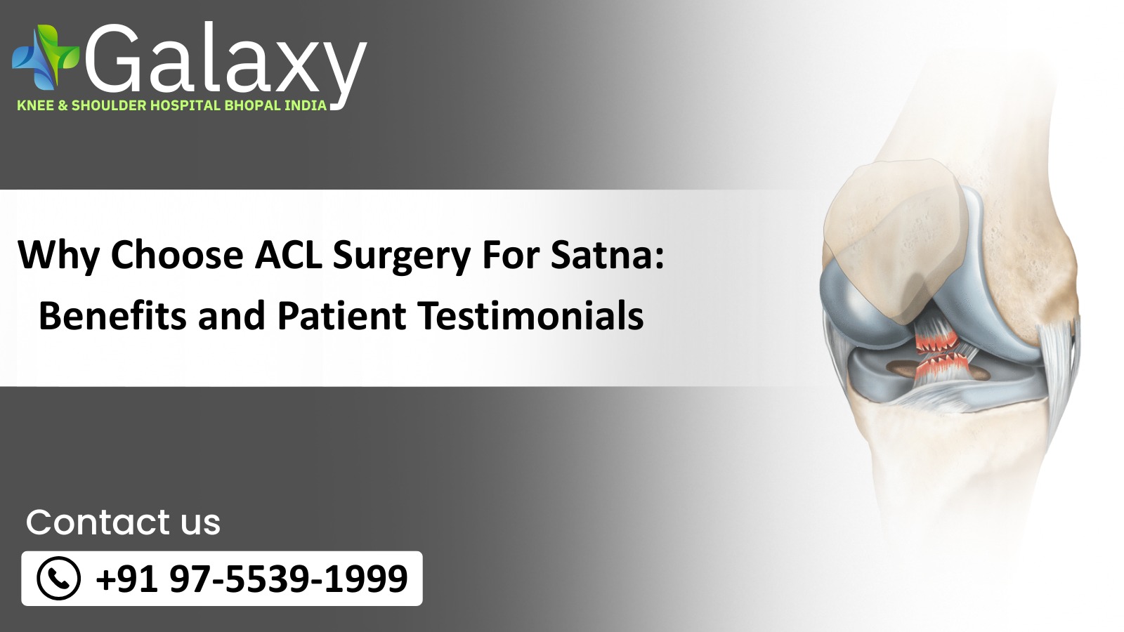 Why Choose ACL Surgery for Satna: Benefits and Patient Testimonials